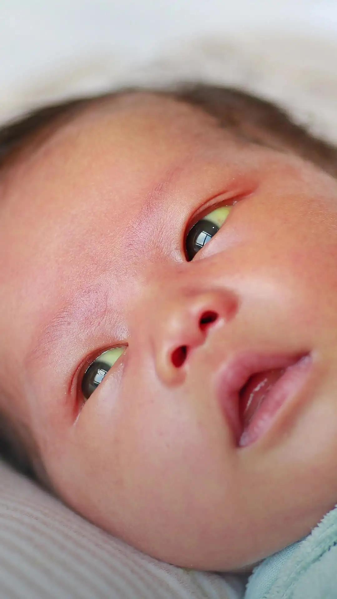 Bayi Kuning